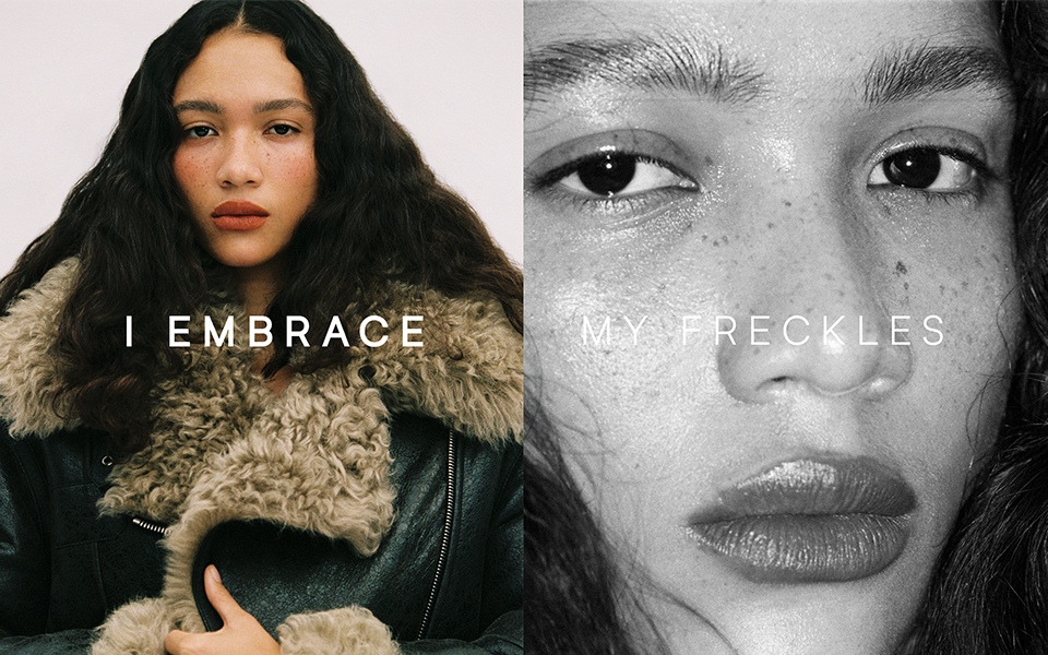 Freckles header image